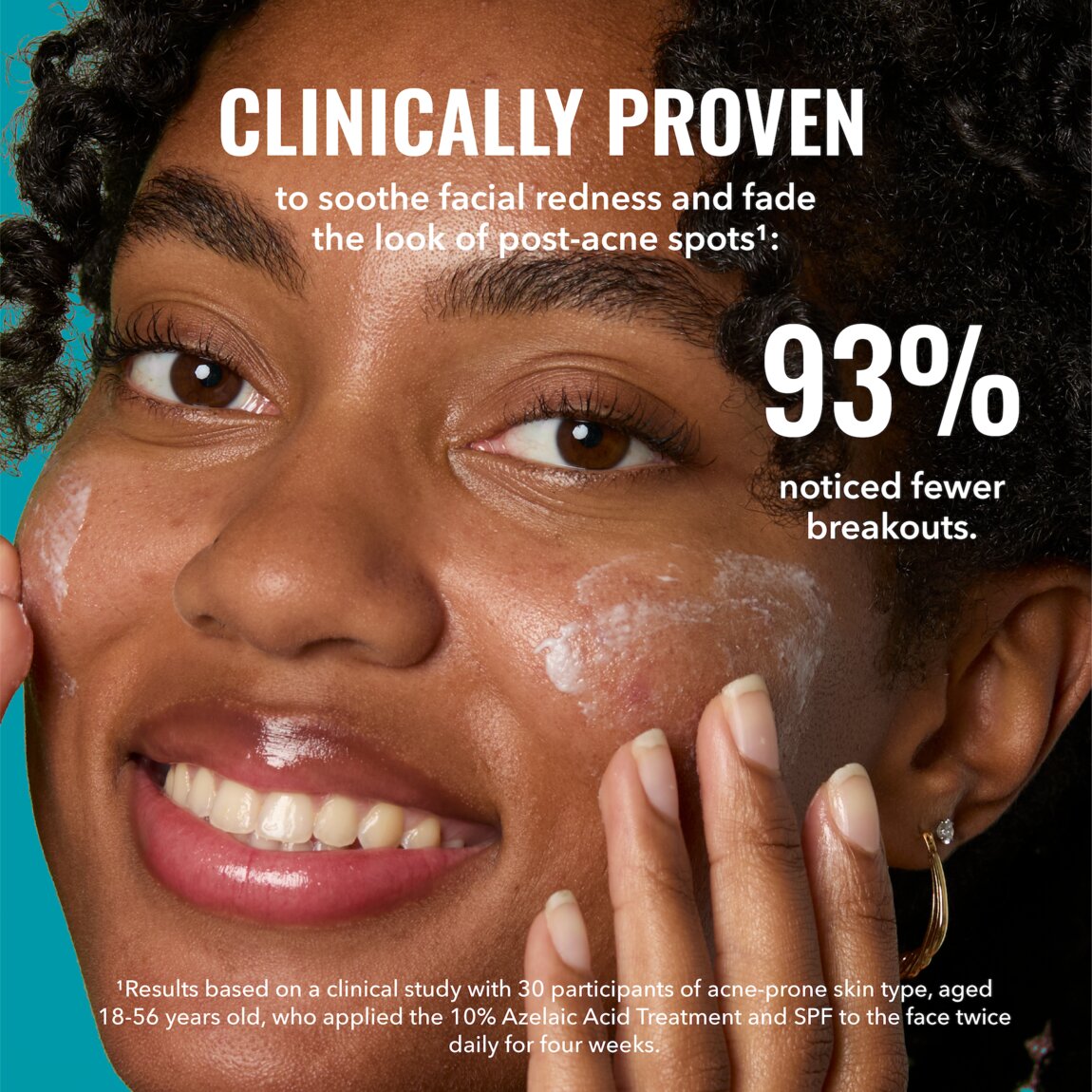 10% Azelaic Acid Treatment