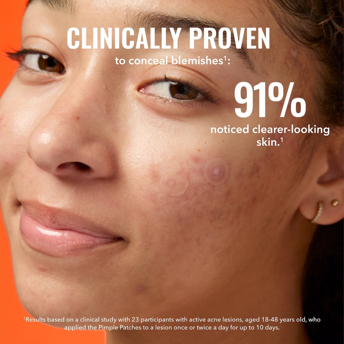 Pimple Patches
