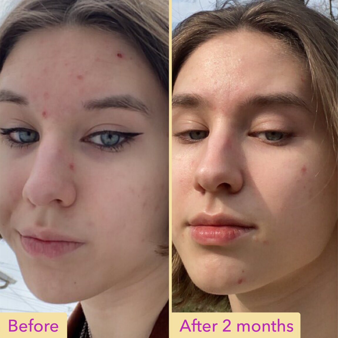 Niacinamide Serum