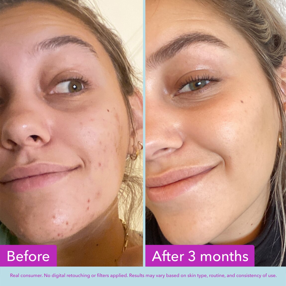 Niacinamide Brightening Toner