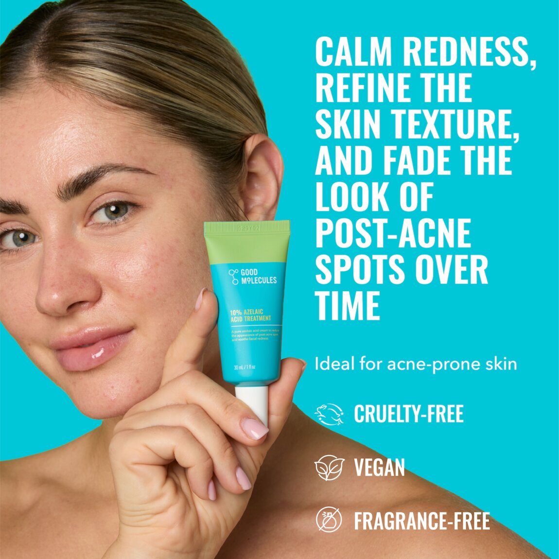 10% Azelaic Acid Treatment